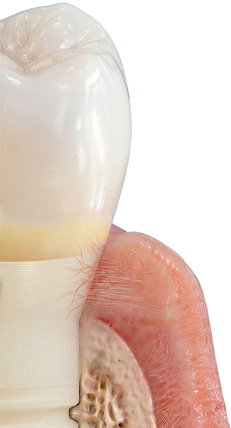 Healthy Symbionic Tooth integrated with gum tissue
